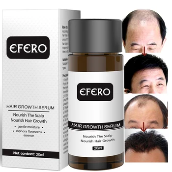 EFERO Plaukų Augimo Esmė Aliejus Greitai Galingas Plaukų Slinkimas Paspartinti Plaukų Augimą, užkirsti Kelią Nuplikimas, Plaukų Augimo Serumo, Essential Care